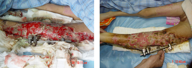 NG电子游戏·(中国区)官方网站