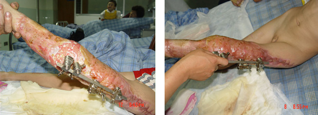 NG电子游戏·(中国区)官方网站