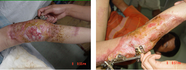 NG电子游戏·(中国区)官方网站