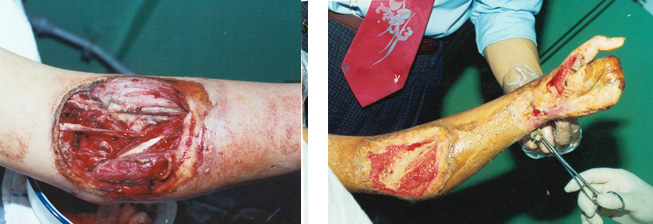 NG电子游戏·(中国区)官方网站