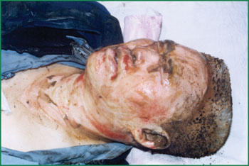 NG电子游戏·(中国区)官方网站