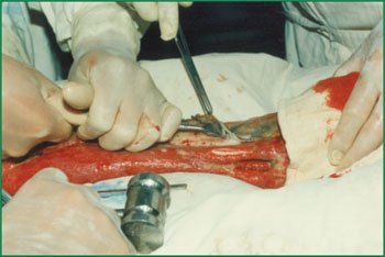 NG电子游戏·(中国区)官方网站