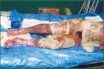 NG电子游戏·(中国区)官方网站