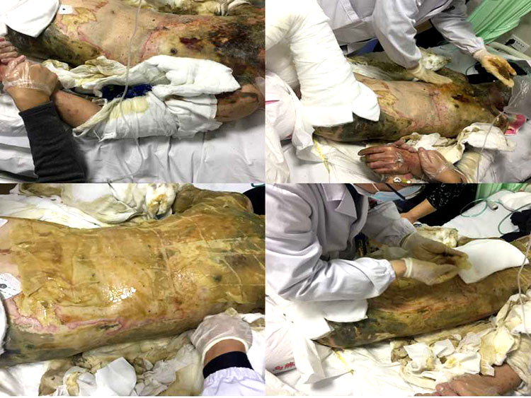 NG电子游戏·(中国区)官方网站