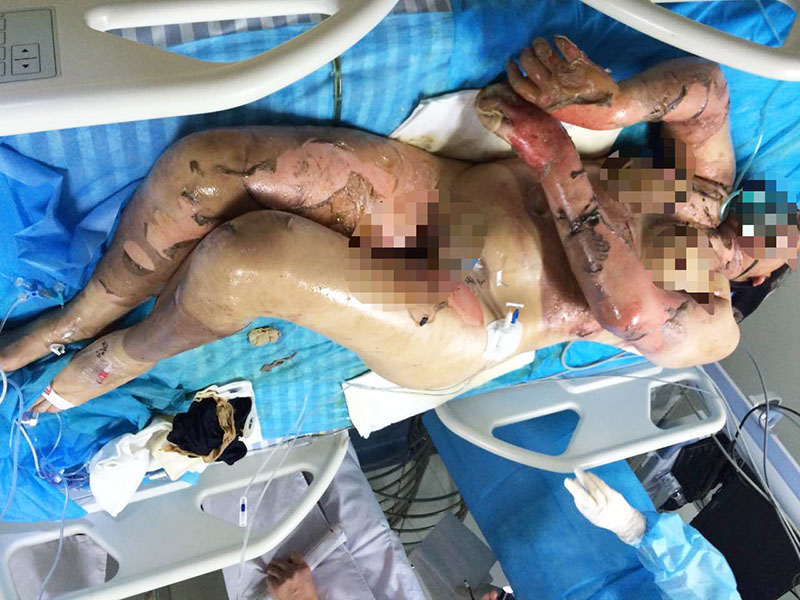 NG电子游戏·(中国区)官方网站