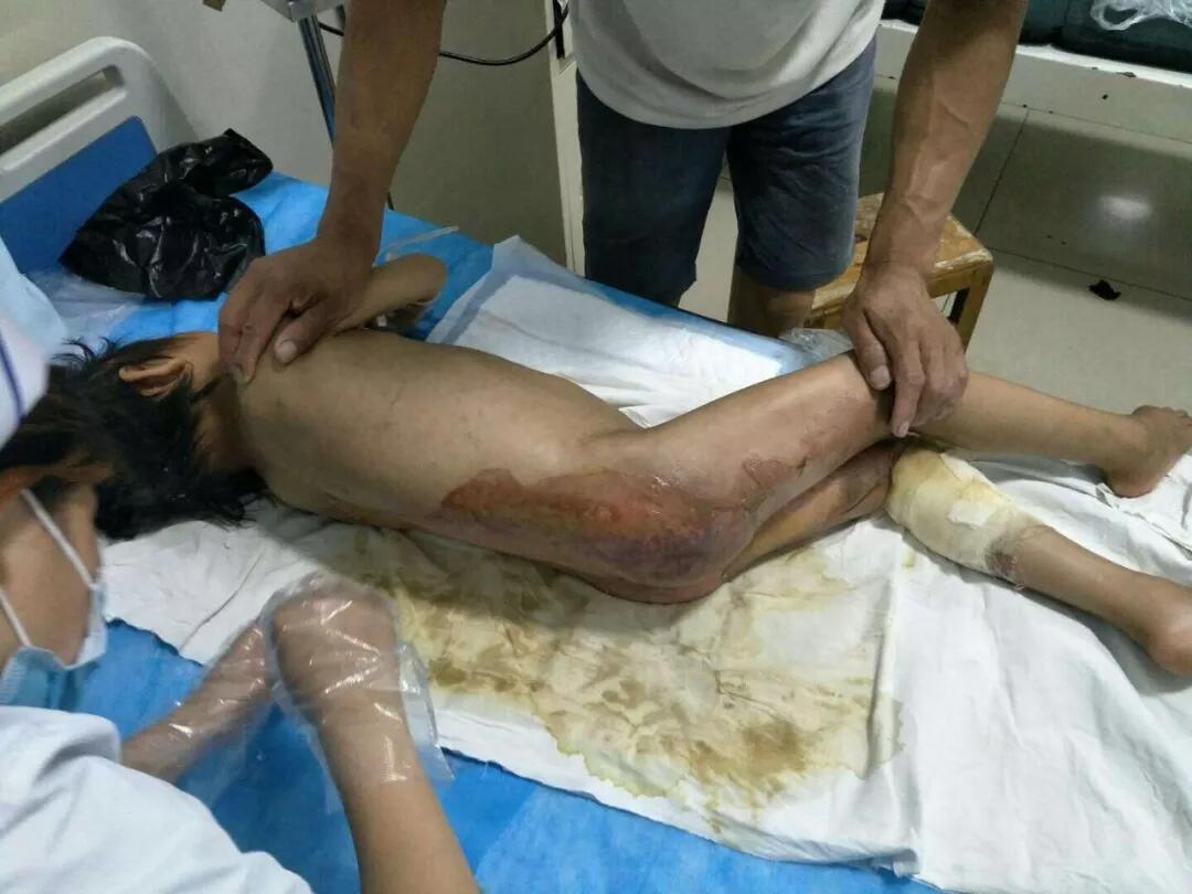 NG电子游戏·(中国区)官方网站