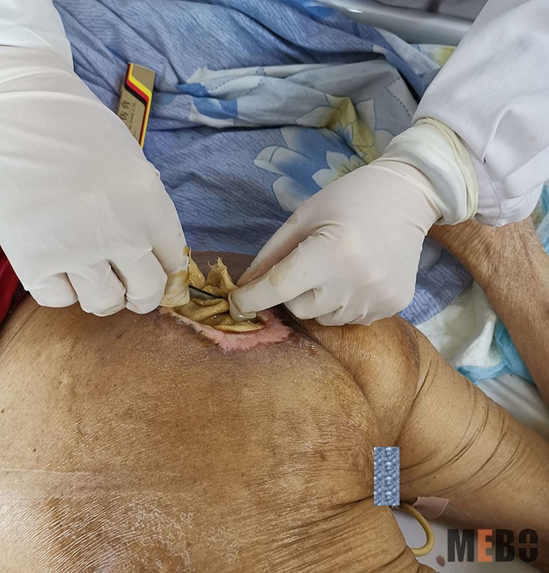 NG电子游戏·(中国区)官方网站