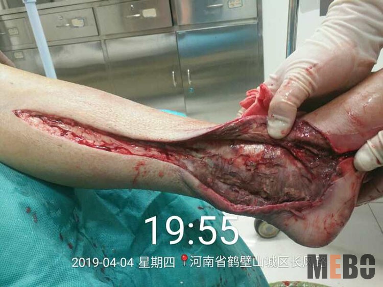 NG电子游戏·(中国区)官方网站