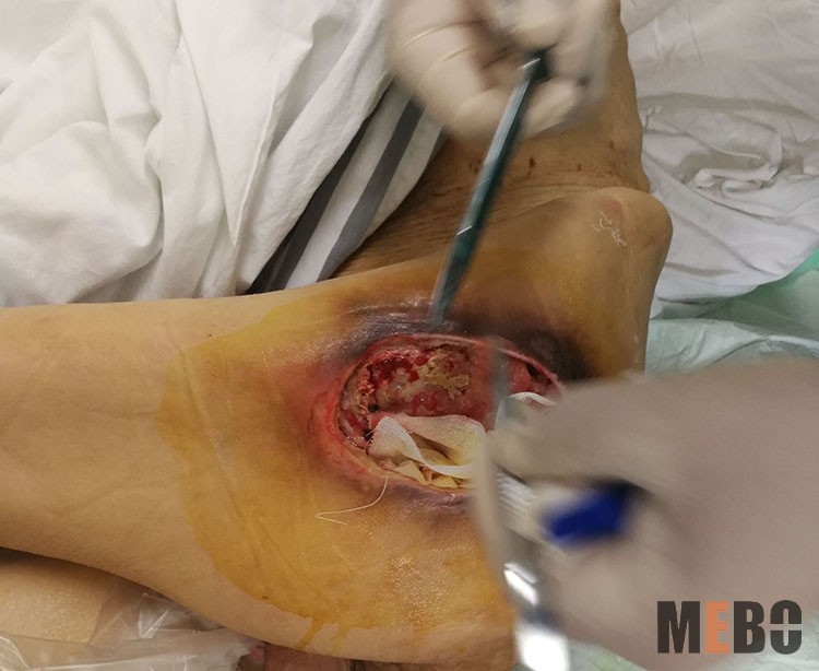 NG电子游戏·(中国区)官方网站