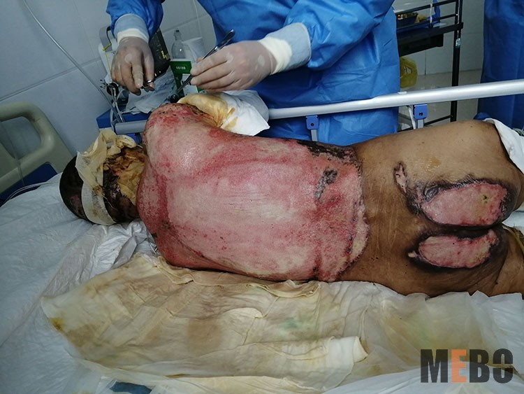 NG电子游戏·(中国区)官方网站