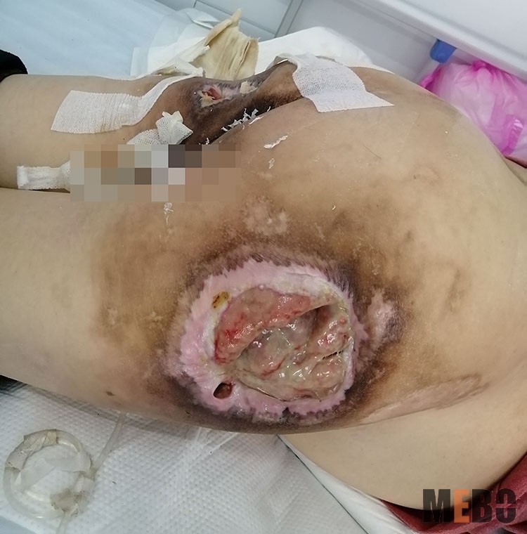 NG电子游戏·(中国区)官方网站