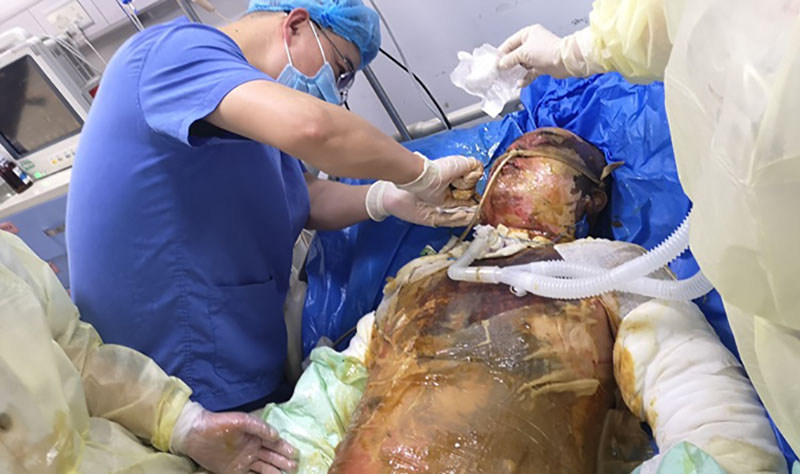 NG电子游戏·(中国区)官方网站