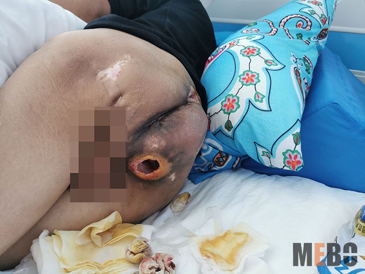 NG电子游戏·(中国区)官方网站