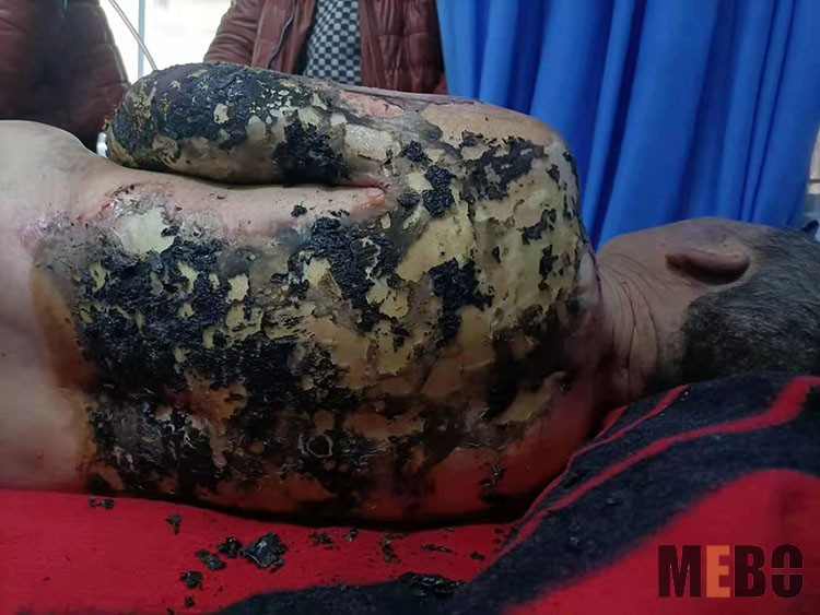 NG电子游戏·(中国区)官方网站