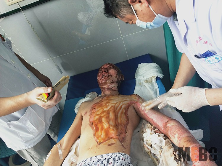 NG电子游戏·(中国区)官方网站