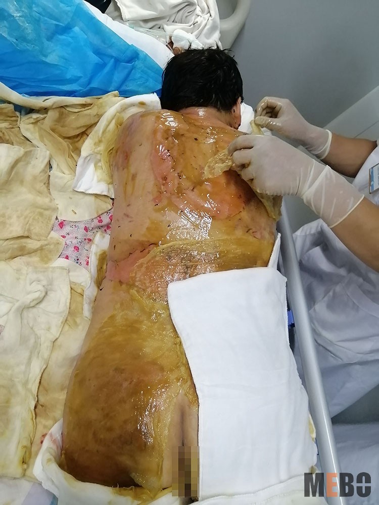 NG电子游戏·(中国区)官方网站