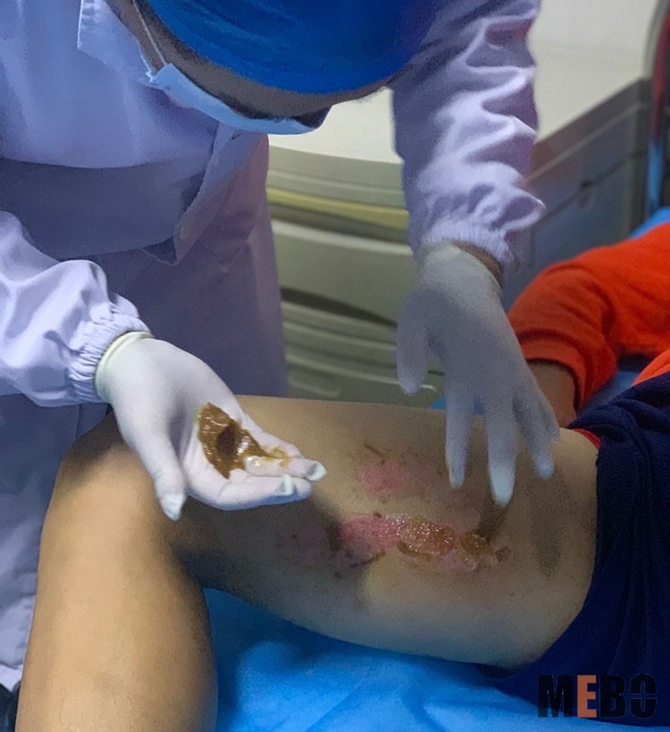 NG电子游戏·(中国区)官方网站