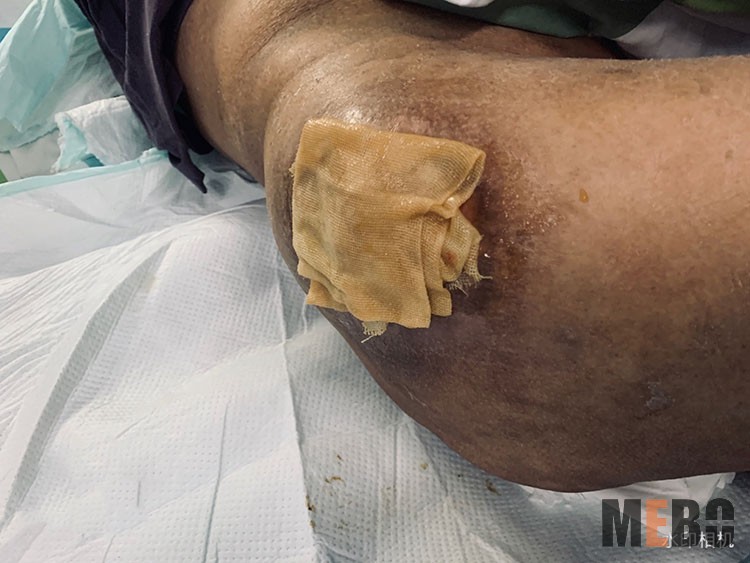 NG电子游戏·(中国区)官方网站