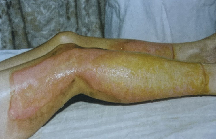 NG电子游戏·(中国区)官方网站