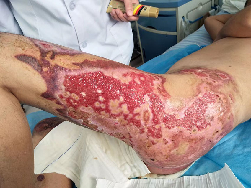 NG电子游戏·(中国区)官方网站