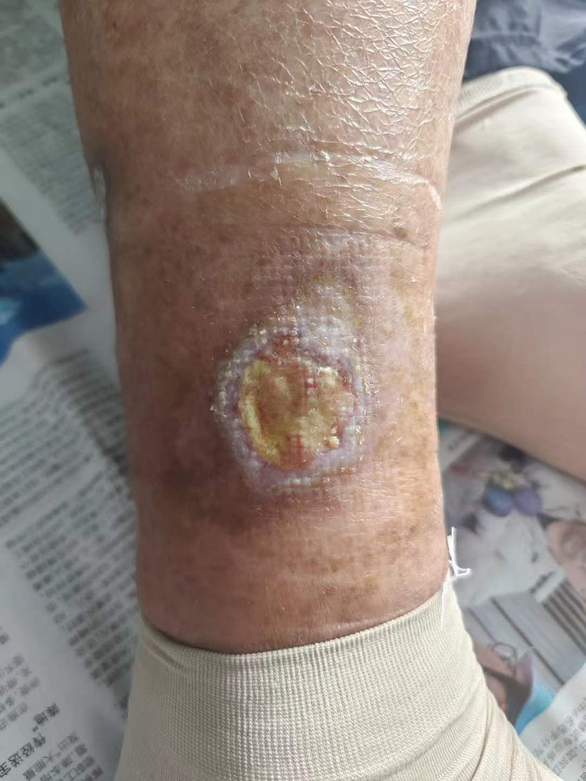 NG电子游戏·(中国区)官方网站