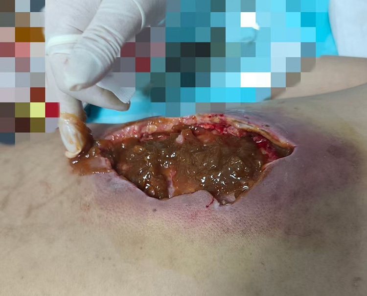 NG电子游戏·(中国区)官方网站