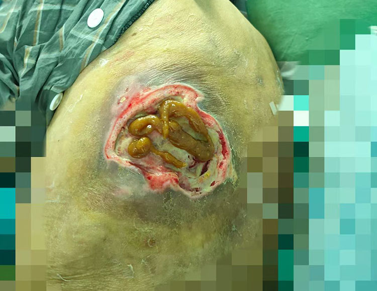 NG电子游戏·(中国区)官方网站