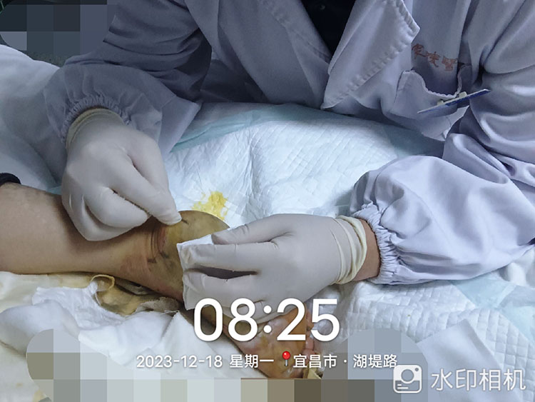 NG电子游戏·(中国区)官方网站