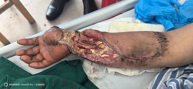 NG电子游戏·(中国区)官方网站