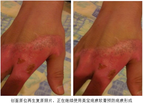 NG电子游戏·(中国区)官方网站