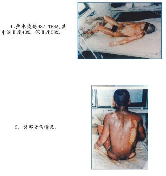 NG电子游戏·(中国区)官方网站