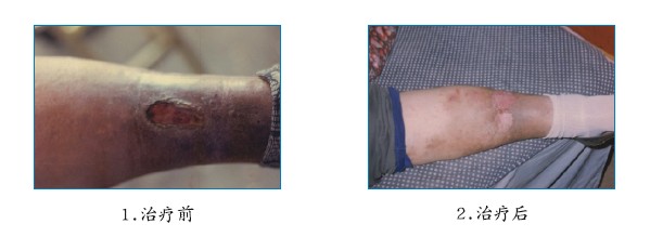 NG电子游戏·(中国区)官方网站