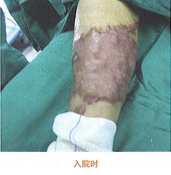 NG电子游戏·(中国区)官方网站