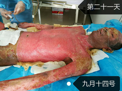 NG电子游戏·(中国区)官方网站