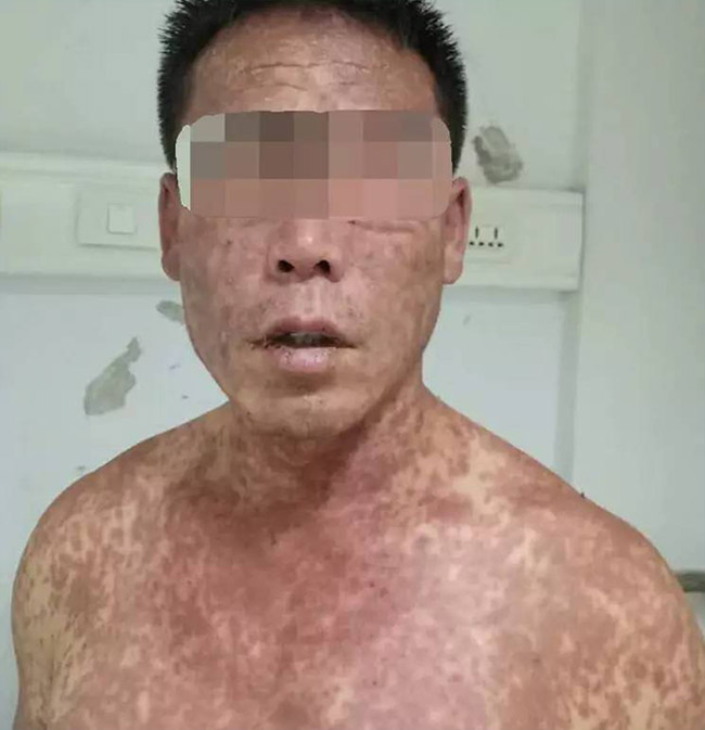 NG电子游戏·(中国区)官方网站