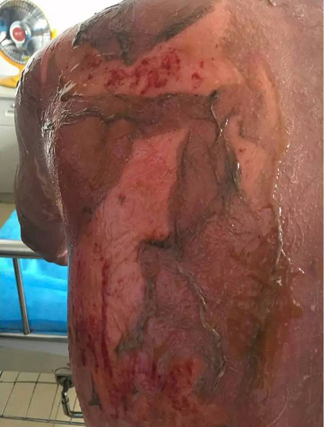 NG电子游戏·(中国区)官方网站