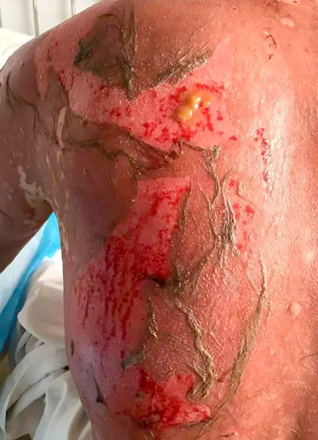 NG电子游戏·(中国区)官方网站