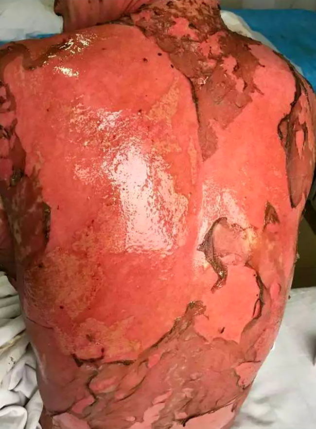 NG电子游戏·(中国区)官方网站