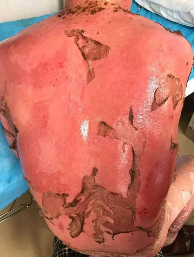 NG电子游戏·(中国区)官方网站