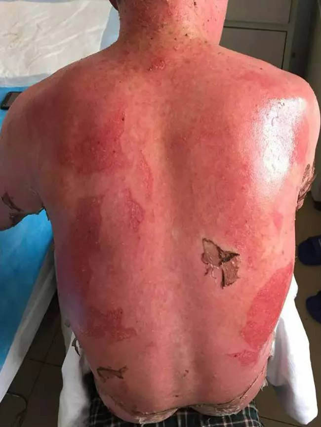 NG电子游戏·(中国区)官方网站