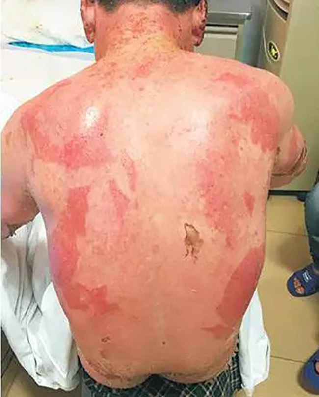 NG电子游戏·(中国区)官方网站